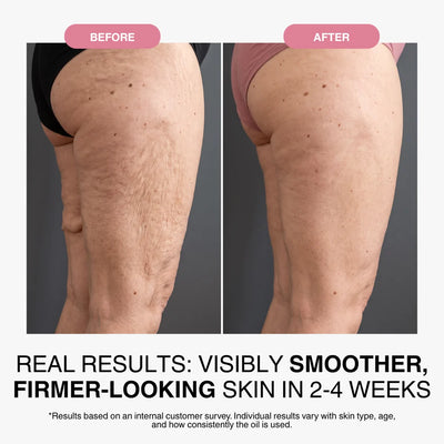 Anti-Aging Body Oil